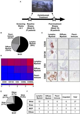 A Pauci-Immune Synovial Pathotype Predicts Inadequate Response to TNFα-Blockade in Rheumatoid Arthritis Patients